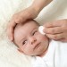 Eczema Treatment